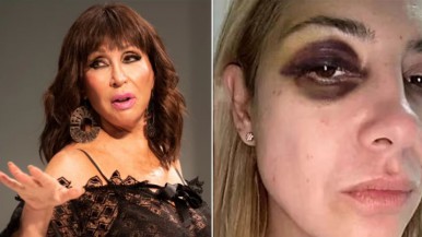 El repudiable comentario de Moria Casán sobre las fotos de Fabiola Yañez golpeada