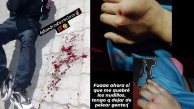 Un joven fue salvajemente atacado en Perito Moreno y su agresor se mostró orgulloso en redes sociales